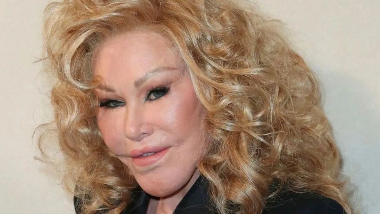 Jocelyn Wildenstein, la "femme chat", nous quitte : retour sur sa vie fascinante